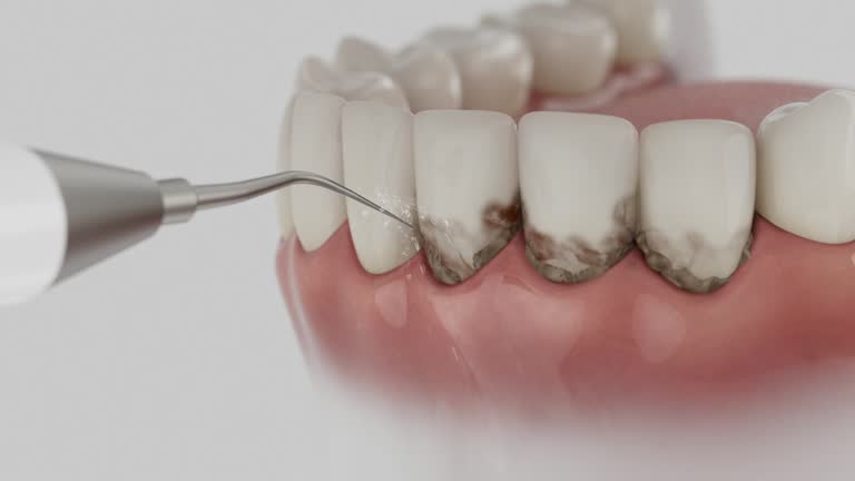Trusted Dental Crowns And Bridges service in Michigan Center, MI - Dentist Open Now